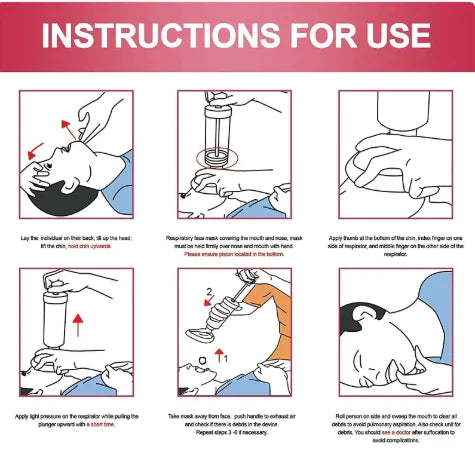 Emergency Anti-Choking Device
