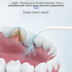 Hand-held Rechargeable Tooth Cleaner After Meals